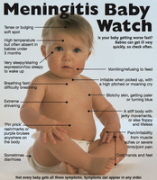 Meningitis Baby Watch