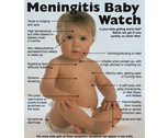 Meningitis Baby Watch